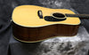1983 Martin HD28 - 150th Year