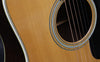 1983 Martin HD28 - 150th Year