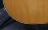 1983 Martin HD28 - 150th Year