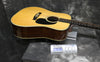 1983 Martin HD28 - 150th Year
