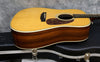 2003 Martin HD28