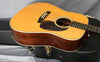 2001 Martin HD28