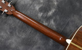 1983 Martin HD28 - 150th Year