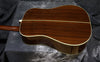 1983 Martin HD28 - 150th Year